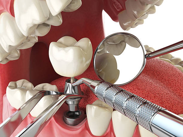 Best Emergency Dental Surgery in Norwood, NC